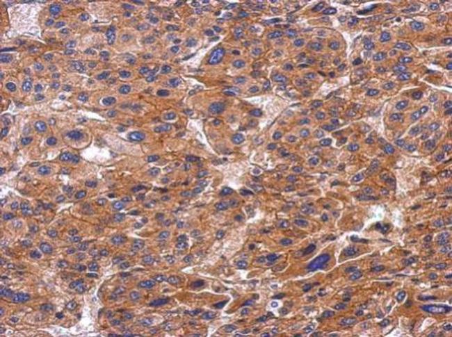 SNX9 Antibody in Immunohistochemistry (Paraffin) (IHC (P))