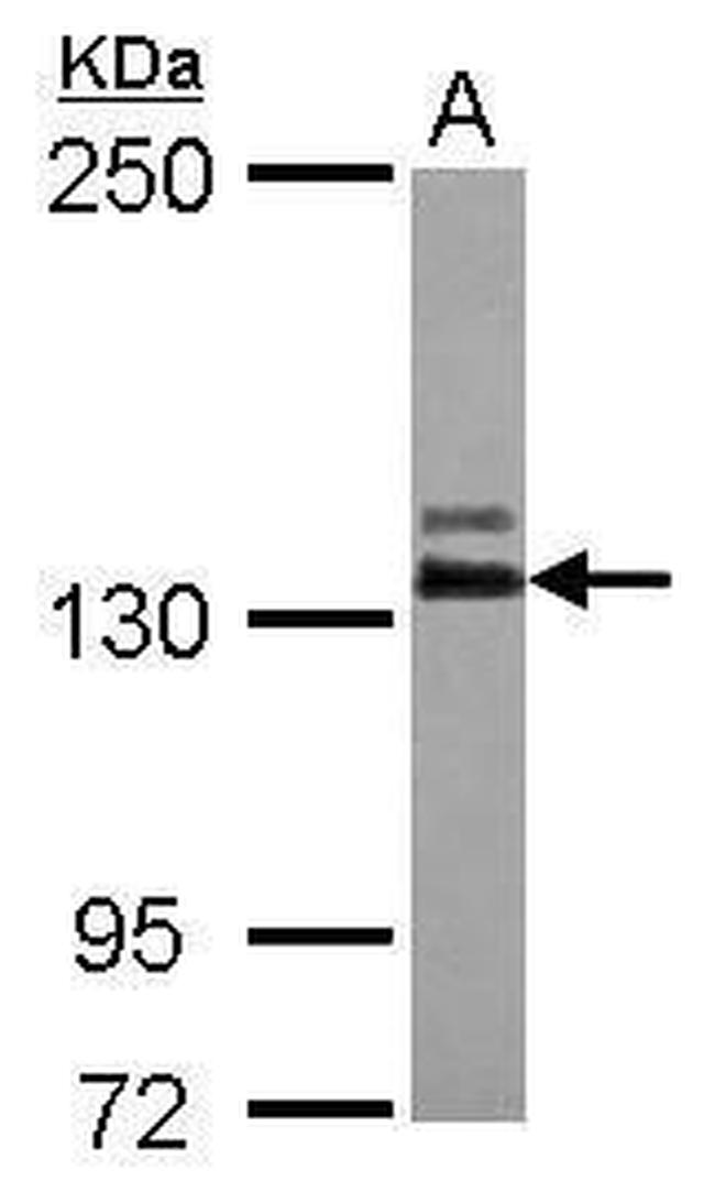 Abl2 Antibody in Western Blot (WB)