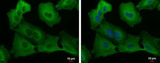 USP8 Antibody in Immunocytochemistry (ICC/IF)