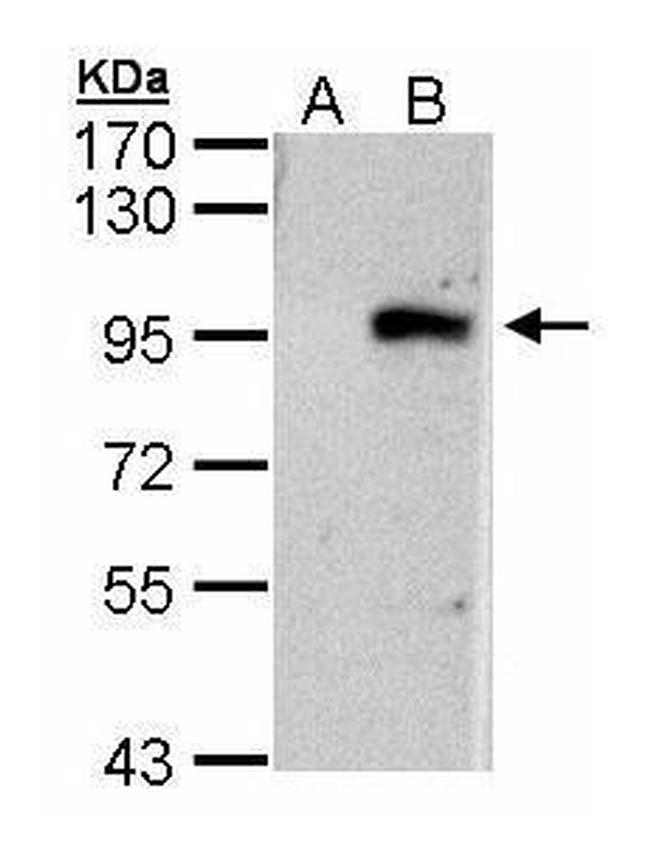 ECEL1 Antibody in Western Blot (WB)