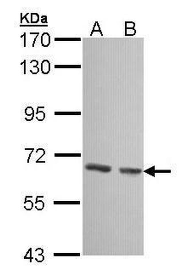 GCKR Antibody in Western Blot (WB)