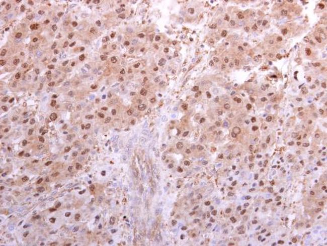 PSMA5 Antibody in Immunohistochemistry (Paraffin) (IHC (P))