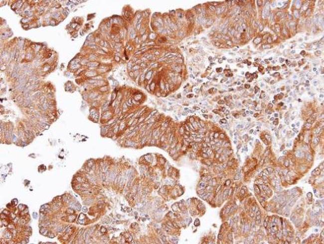 DVL2 Antibody in Immunohistochemistry (Paraffin) (IHC (P))