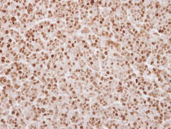 UHRF1 Antibody in Immunohistochemistry (Paraffin) (IHC (P))