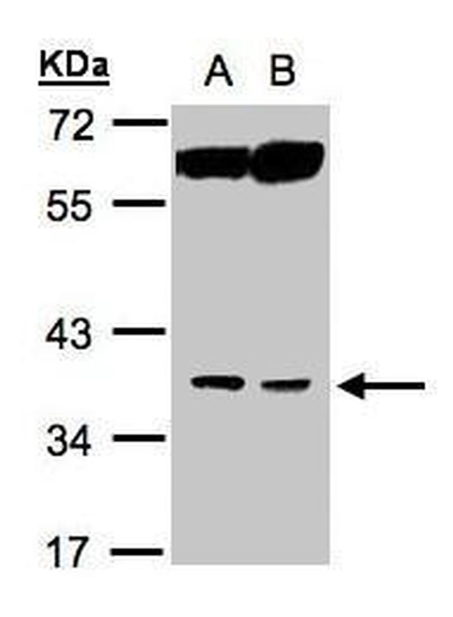 ACOT8 Antibody in Western Blot (WB)