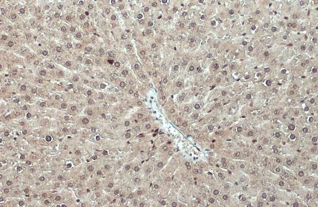 RPS3 Antibody in Immunohistochemistry (Paraffin) (IHC (P))