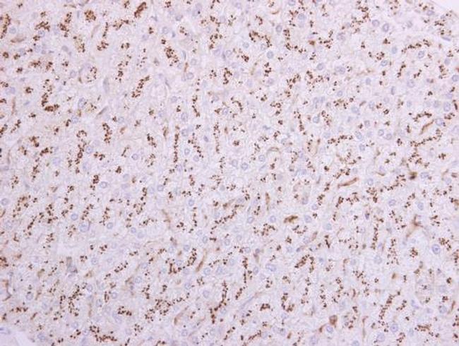 ST6GAL1 Antibody in Immunohistochemistry (Paraffin) (IHC (P))