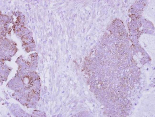 Arginase 2 Antibody in Immunohistochemistry (Paraffin) (IHC (P))