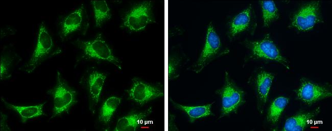 PDHB Antibody in Immunocytochemistry (ICC/IF)