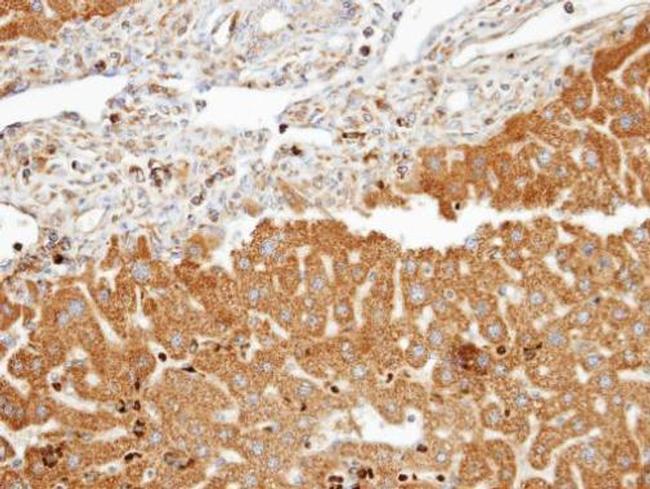 FDFT1 Antibody in Immunohistochemistry (Paraffin) (IHC (P))