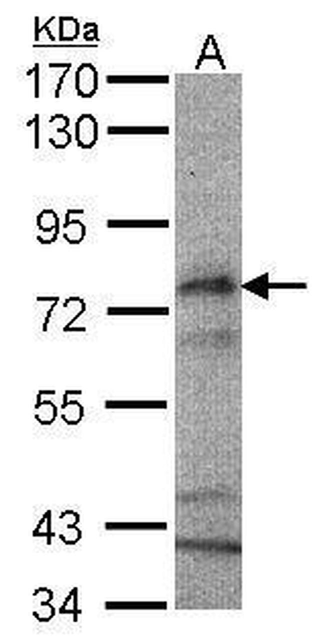 CPT2 Antibody in Western Blot (WB)