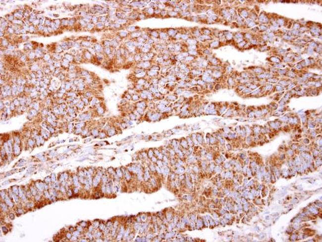 PACSIN2 Antibody in Immunohistochemistry (Paraffin) (IHC (P))