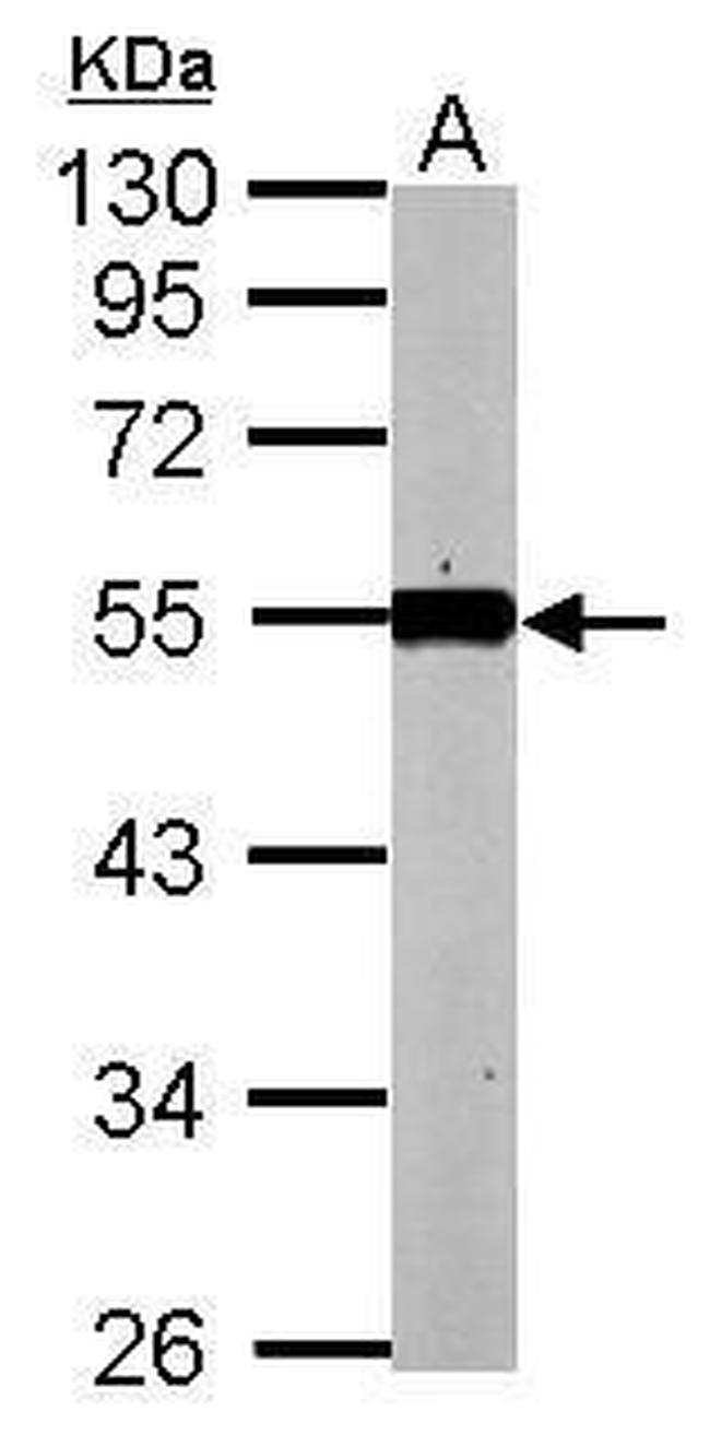 KLF12 Antibody in Western Blot (WB)