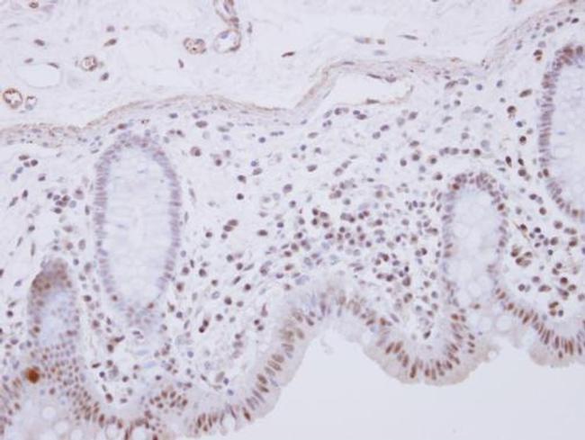 RCL1 Antibody in Immunohistochemistry (Paraffin) (IHC (P))