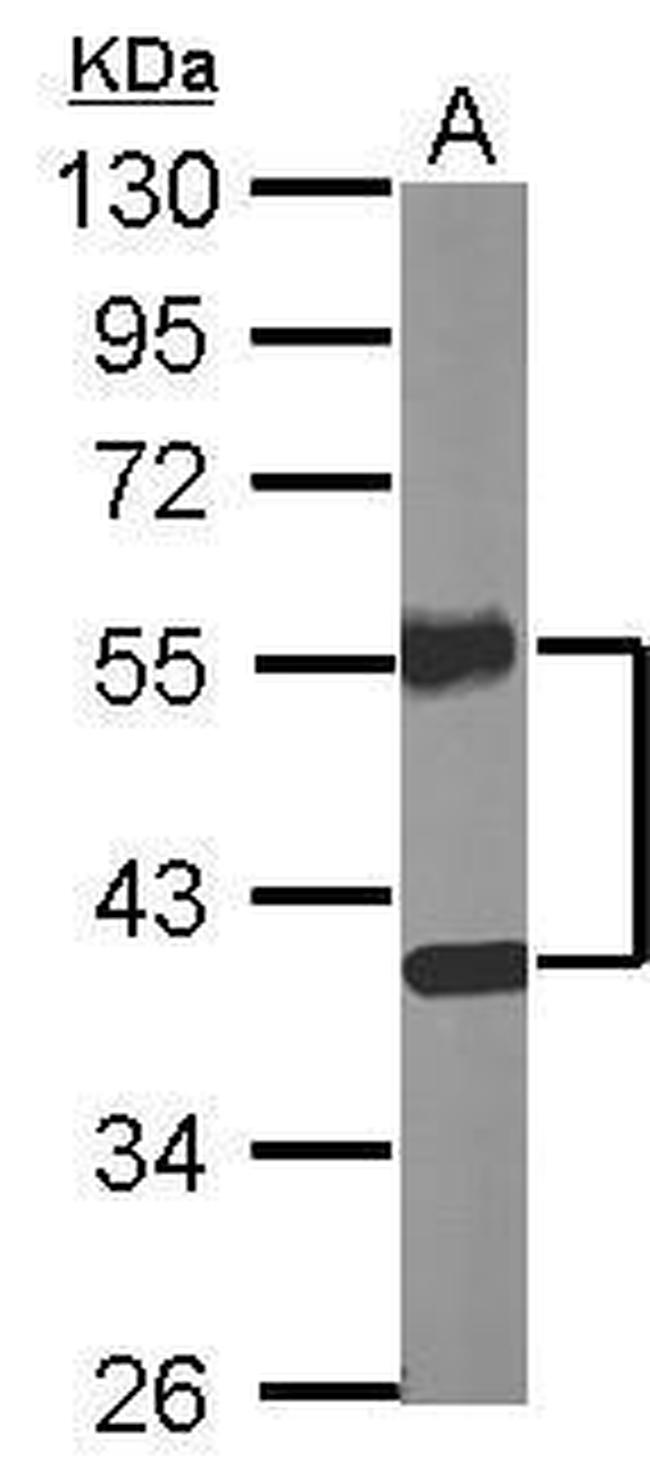 NR2F2 Antibody in Western Blot (WB)