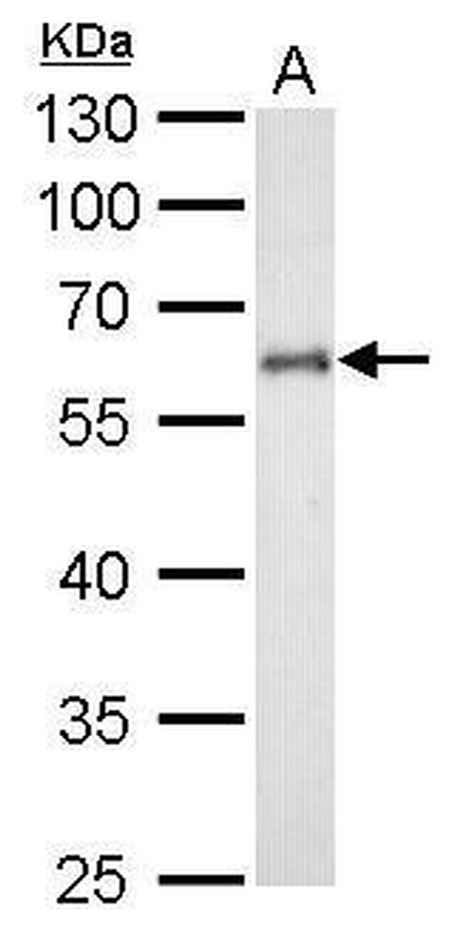 CYP1B1 Antibody in Western Blot (WB)