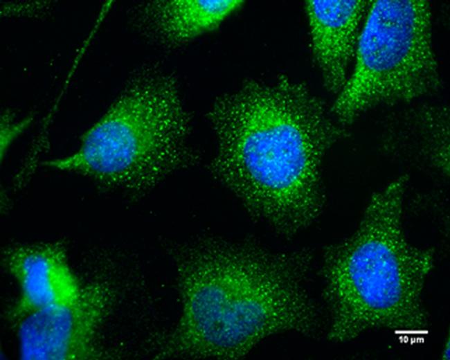 Bif1 Antibody in Immunocytochemistry (ICC/IF)