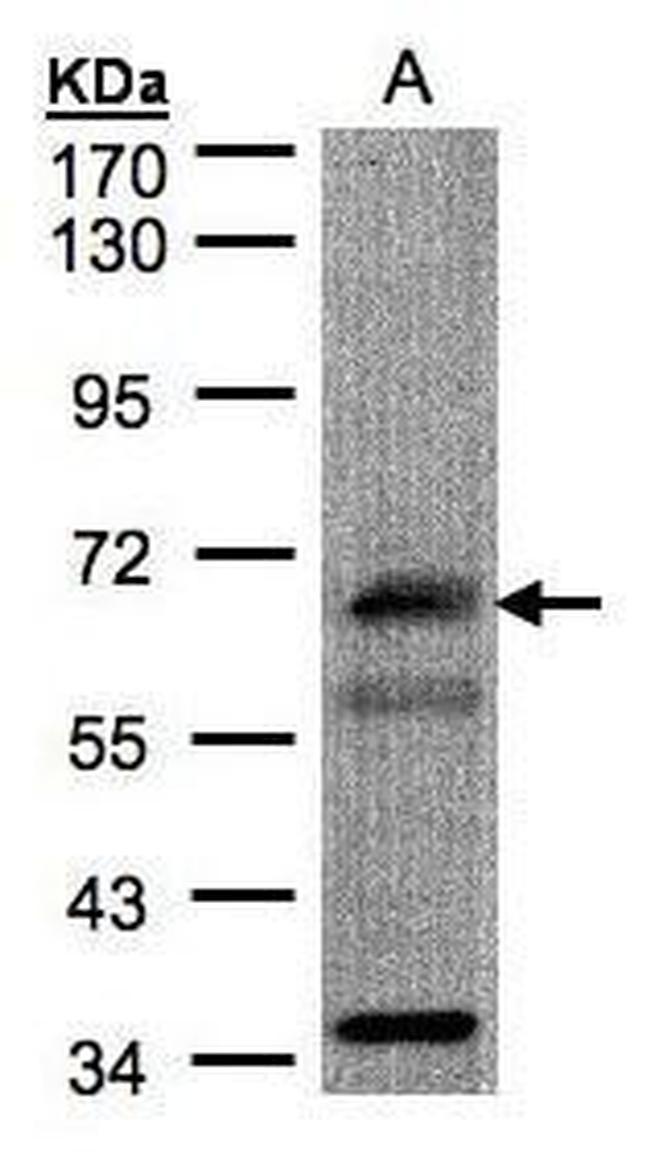 CHFR Antibody in Western Blot (WB)