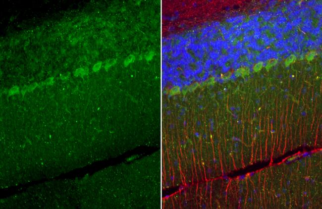 TRPC6 Antibody in Immunohistochemistry (Paraffin) (IHC (P))