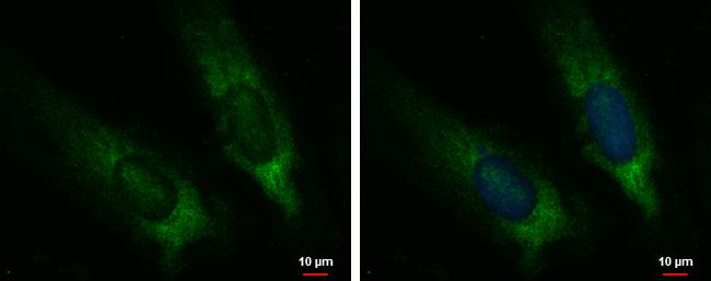 CYP7B1 Antibody in Immunocytochemistry (ICC/IF)