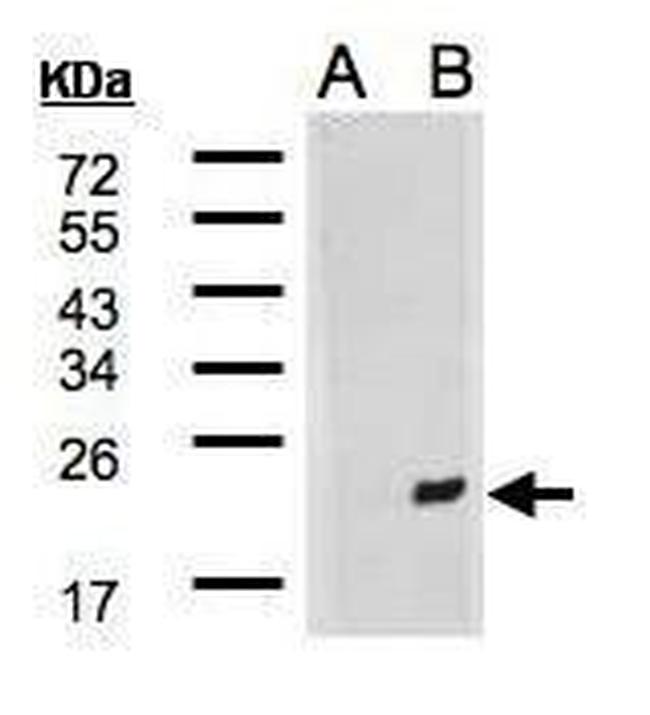 DNAJB9 Antibody in Western Blot (WB)