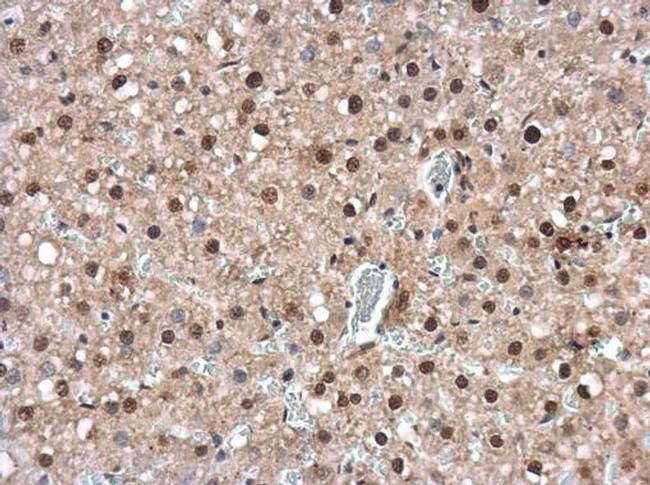 IRF6 Antibody in Immunohistochemistry (Paraffin) (IHC (P))