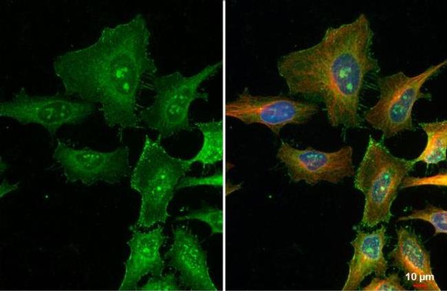 FBXL2 Antibody in Immunocytochemistry (ICC/IF)