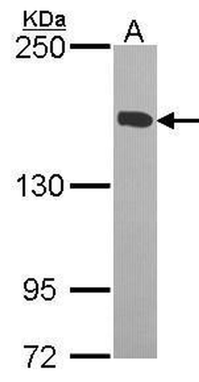 KIF4A Antibody in Western Blot (WB)