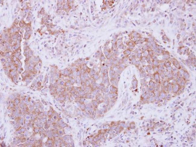 ADAM10 Antibody in Immunohistochemistry (Paraffin) (IHC (P))