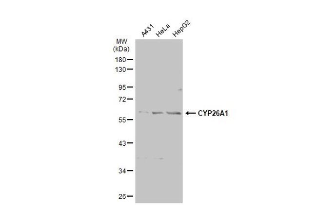 CYP26A1 Antibody in Western Blot (WB)