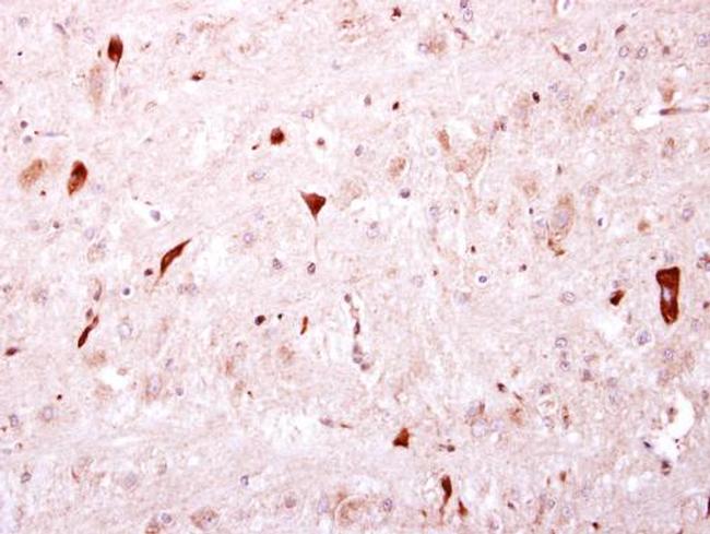 BTD Antibody in Immunohistochemistry (Paraffin) (IHC (P))