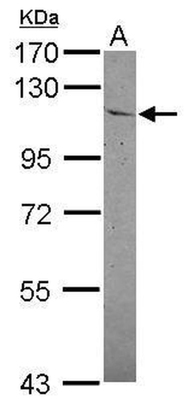 IDE Antibody in Western Blot (WB)