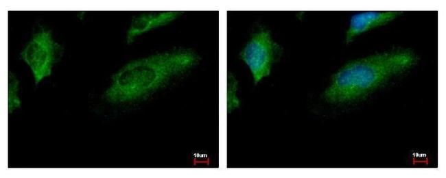 CALCOCO1 Antibody in Immunocytochemistry (ICC/IF)