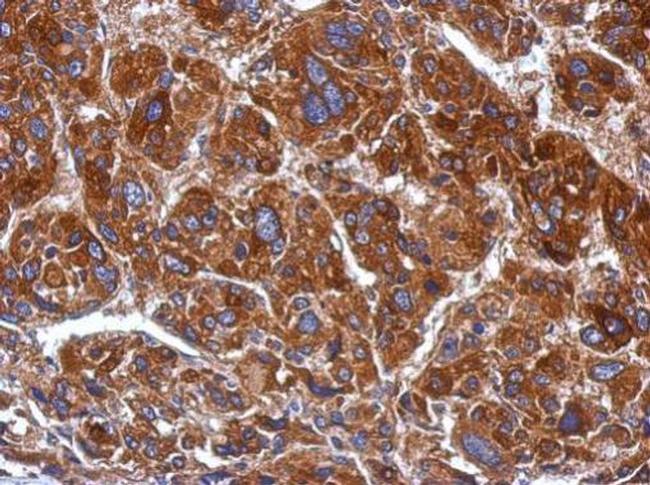 POLRMT Antibody in Immunohistochemistry (Paraffin) (IHC (P))