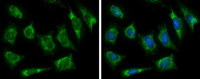 HADH Antibody in Immunocytochemistry (ICC/IF)