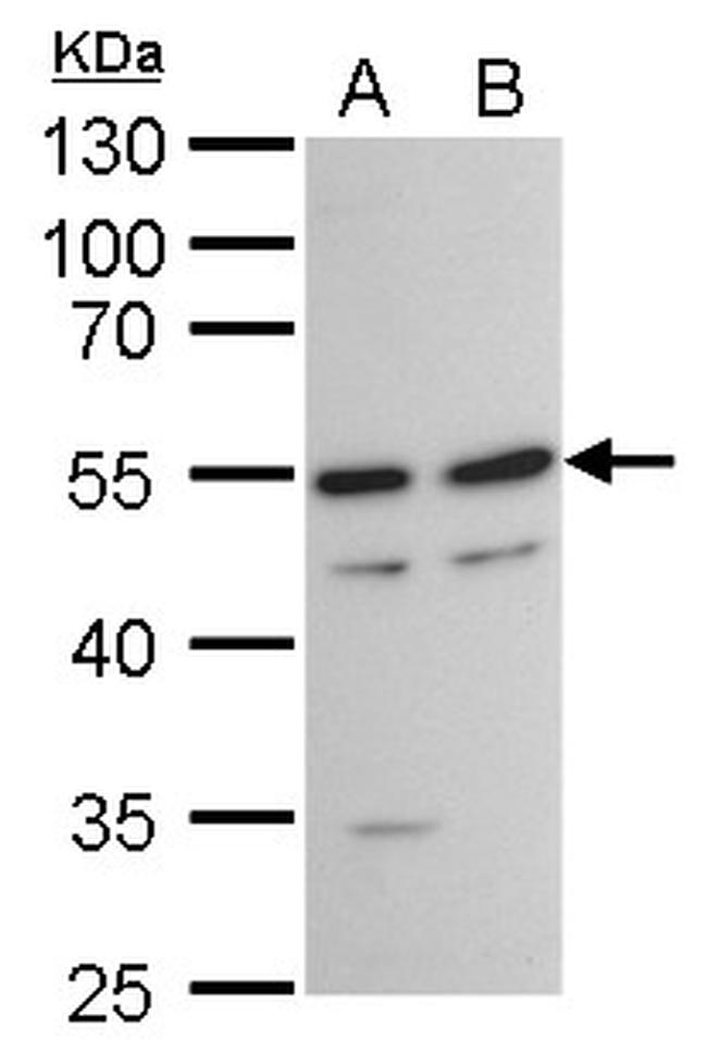 TAF7 Antibody in Western Blot (WB)