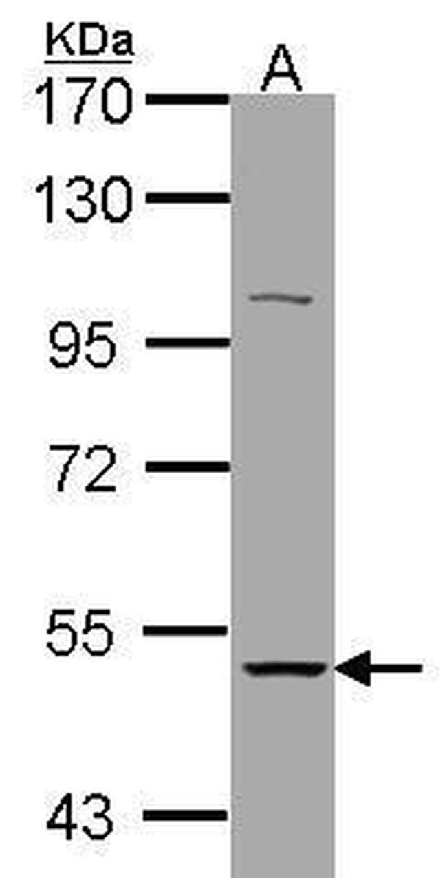 CHRNA3 Antibody in Western Blot (WB)