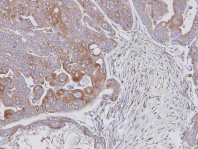 JNK2 Antibody in Immunohistochemistry (Paraffin) (IHC (P))