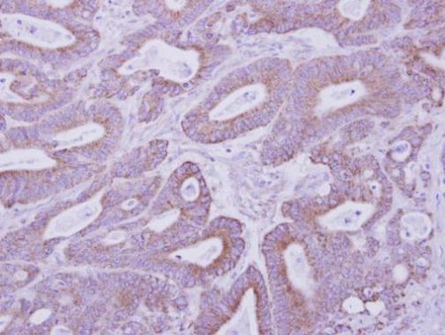 PRKAR2B Antibody in Immunohistochemistry (Paraffin) (IHC (P))