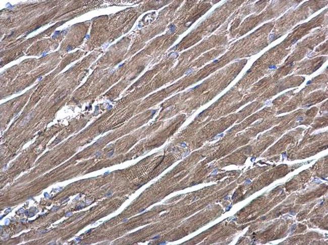 RRAS Antibody in Immunohistochemistry (Paraffin) (IHC (P))