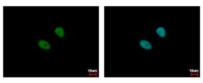 MSL3 Antibody in Immunocytochemistry (ICC/IF)