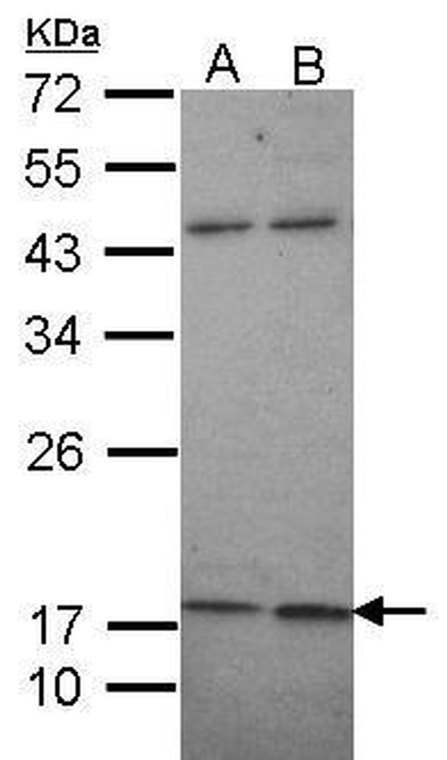 KCNMB1 Antibody in Western Blot (WB)