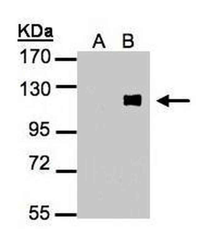 ZNF281 Antibody in Western Blot (WB)