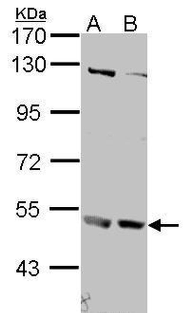 IFNAR2 Antibody in Western Blot (WB)