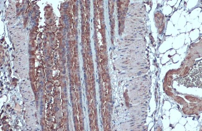 IL13RA1 Antibody in Immunohistochemistry (Paraffin) (IHC (P))