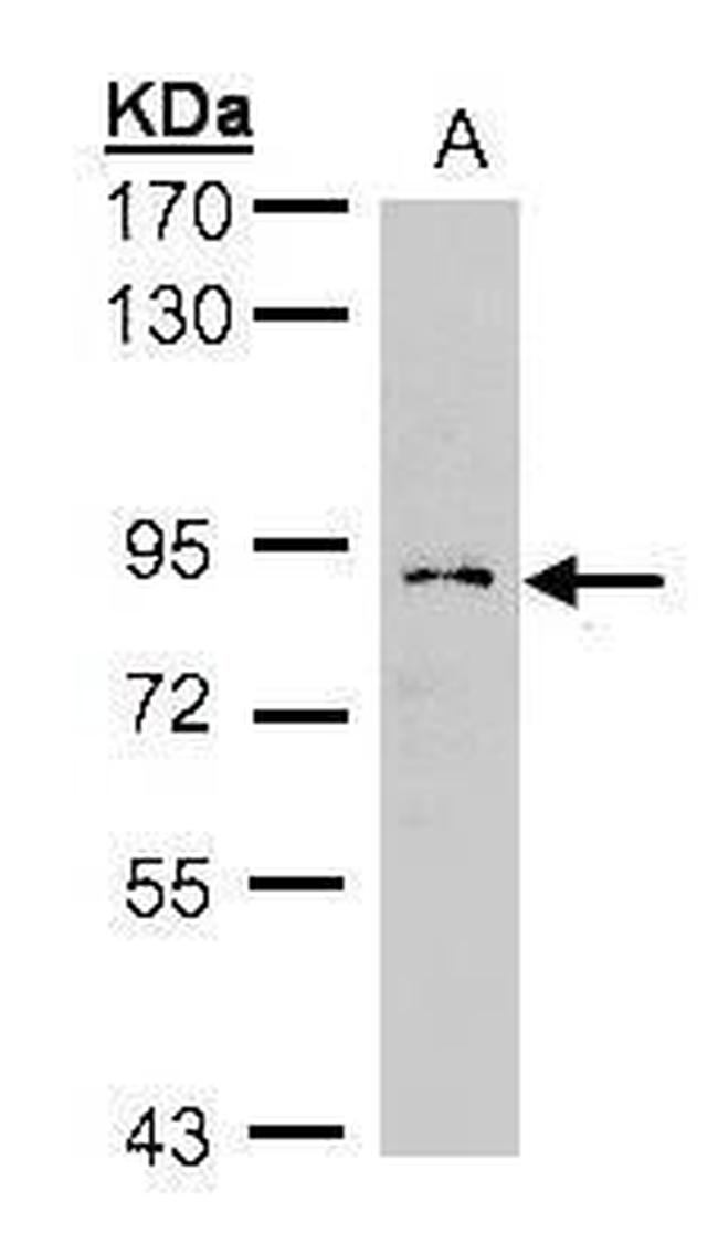 GCS1 Antibody in Western Blot (WB)