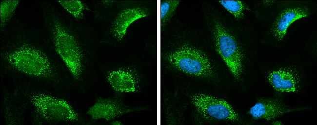 KEAP1 Antibody in Immunocytochemistry (ICC/IF)