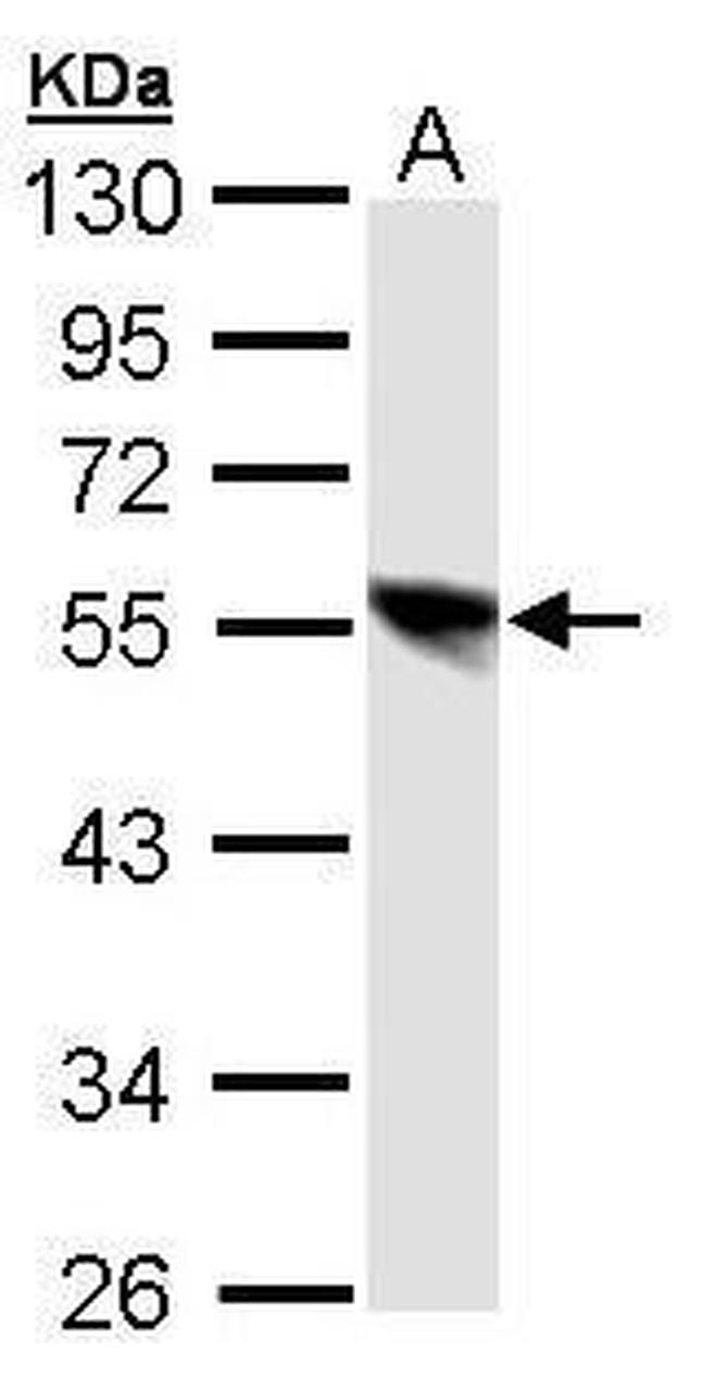 DP1 Antibody in Western Blot (WB)