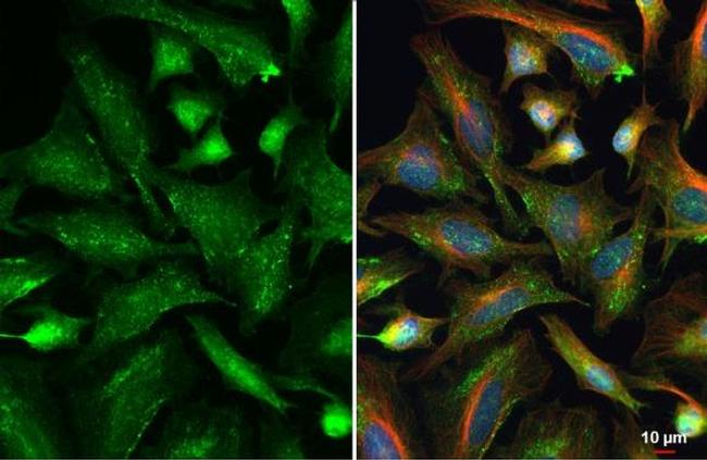 VPS26A Antibody in Immunocytochemistry (ICC/IF)