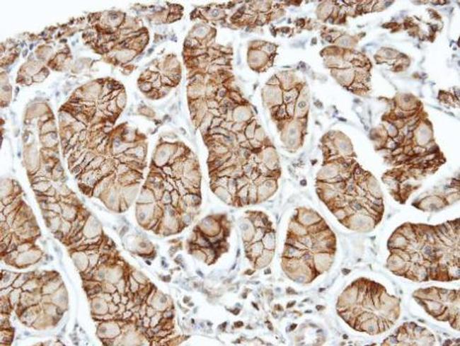 ELMO1 Antibody in Immunohistochemistry (Paraffin) (IHC (P))